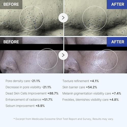 Medicube, One Day Exosome Shot 7500 , 1.01 Fl Oz (30 Ml)
